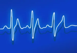 Wie funktioniert ein EKG?