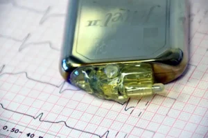 Herzschrittmacher – Eine kleine Hilfe für das Herz